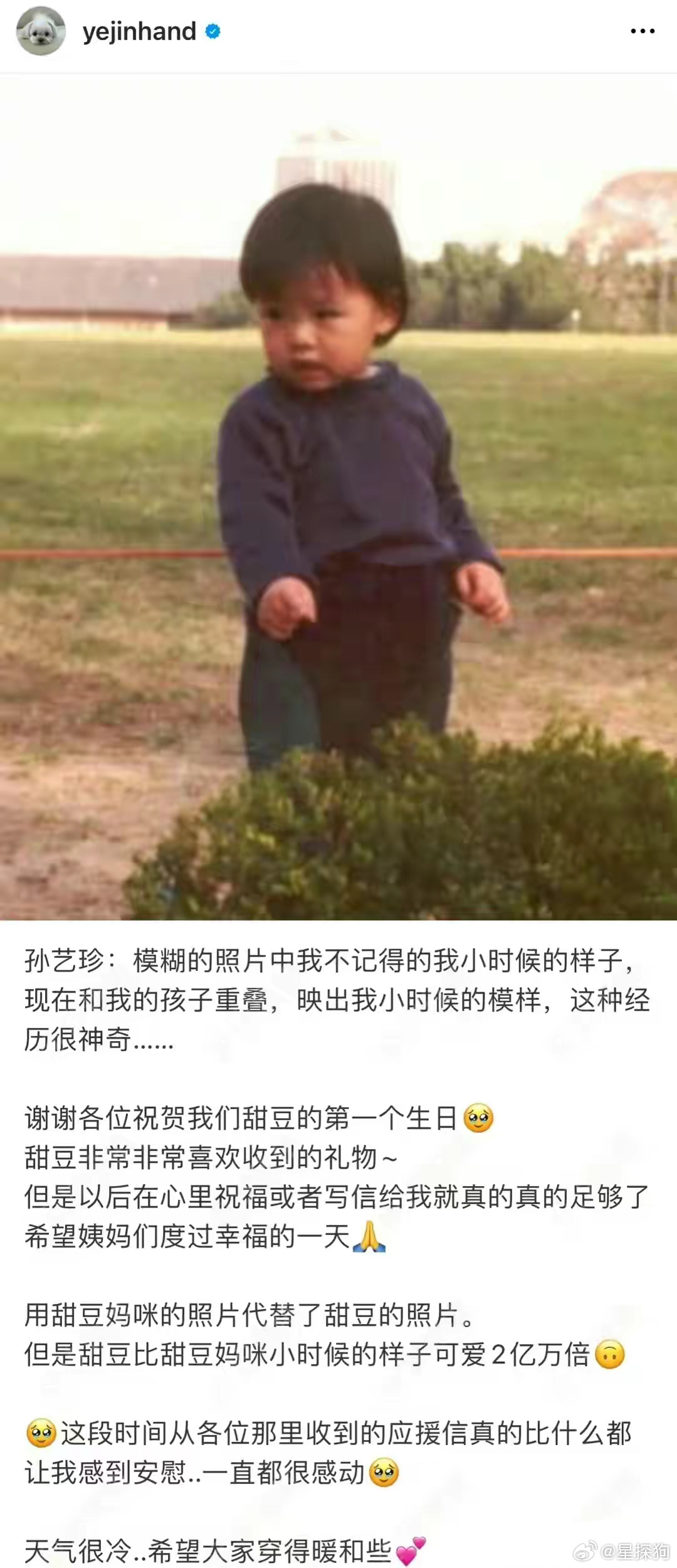 #孙艺珍庆祝儿子一岁生日#孙艺珍庆祝儿子小甜豆一岁生日，晒出儿时照片，肉嘟嘟的太