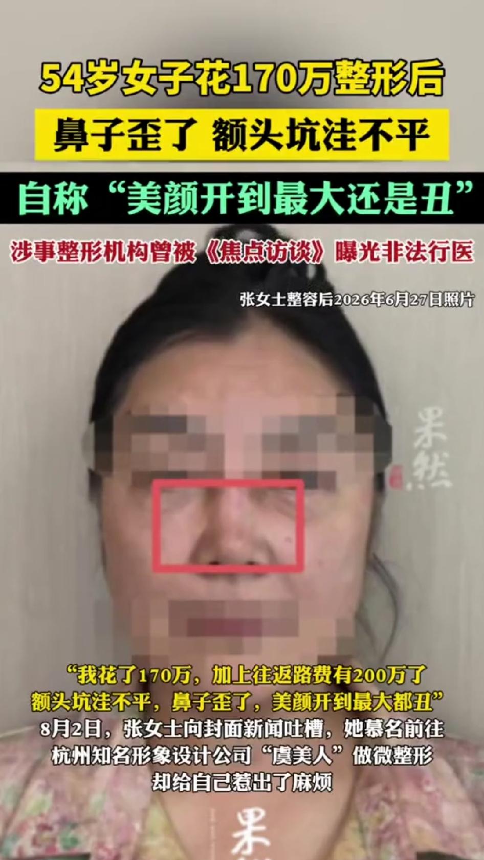 54岁的张女士通过封面新闻公开维权。她身在国外，慕名回国到杭州虞美人医美机构做面