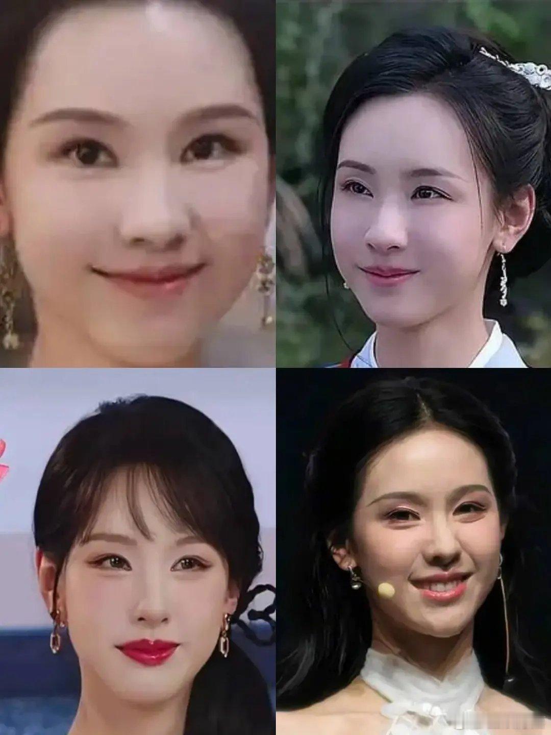 陈都灵的脸怎么变了 