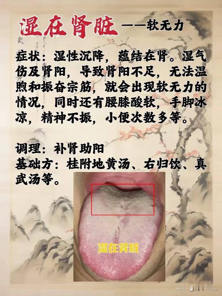 湿在肝胆阴囊潮，湿在脾胃续航差，湿在肾脏软无力，中医帮你从头到脚祛湿气。

#健