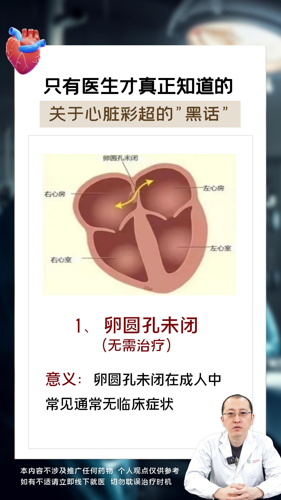 只有医生才真正知道的关于心脏彩超“黑话“。