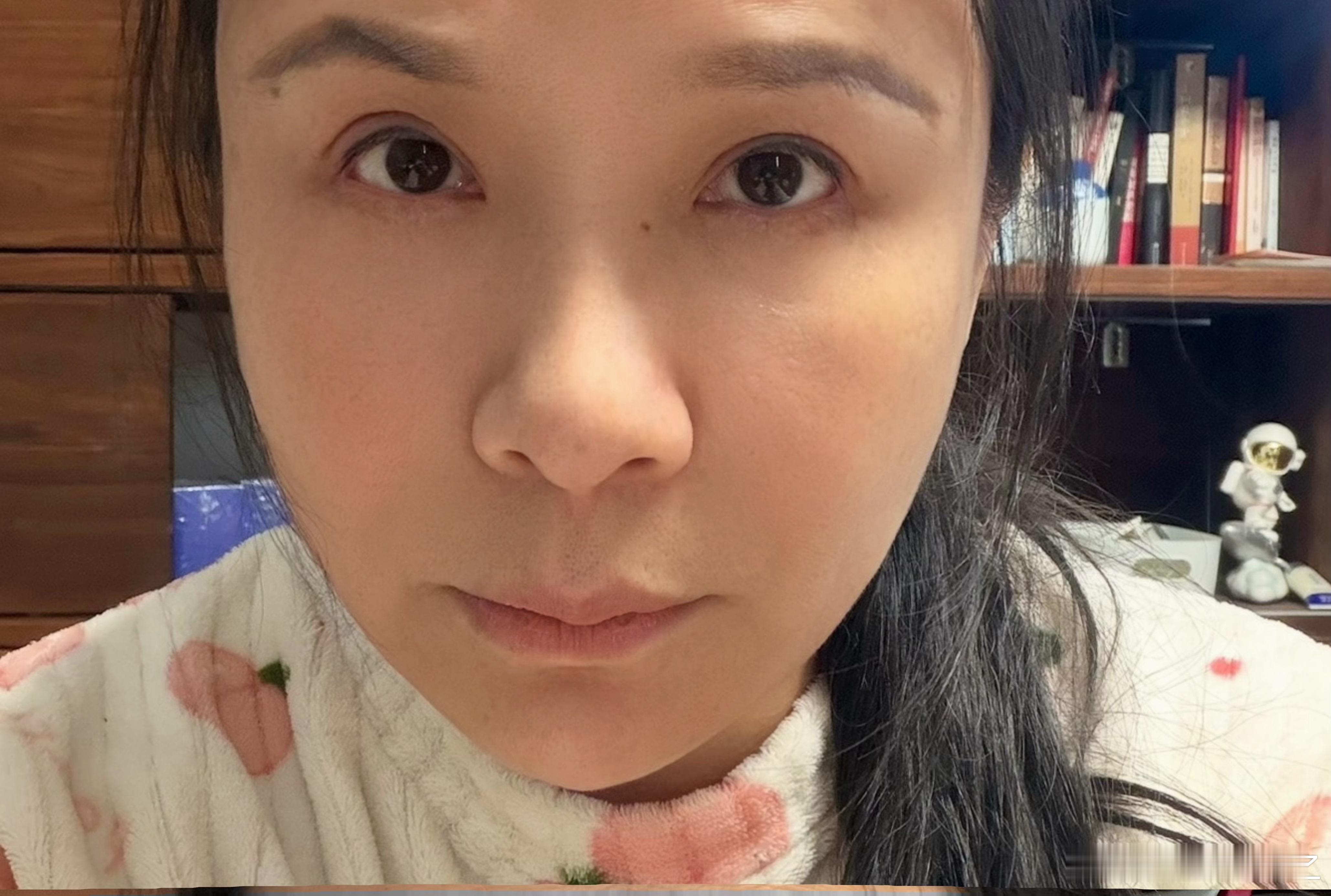 又是对称性越来越恢复的新一天。如非这次彻底的康复之旅，我都忘记了自己原本的样子了