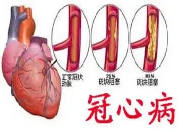 《缺血性心脏病：症状表现、发病成因与前沿治疗进展》
 
摘要： 缺血性心脏病严重