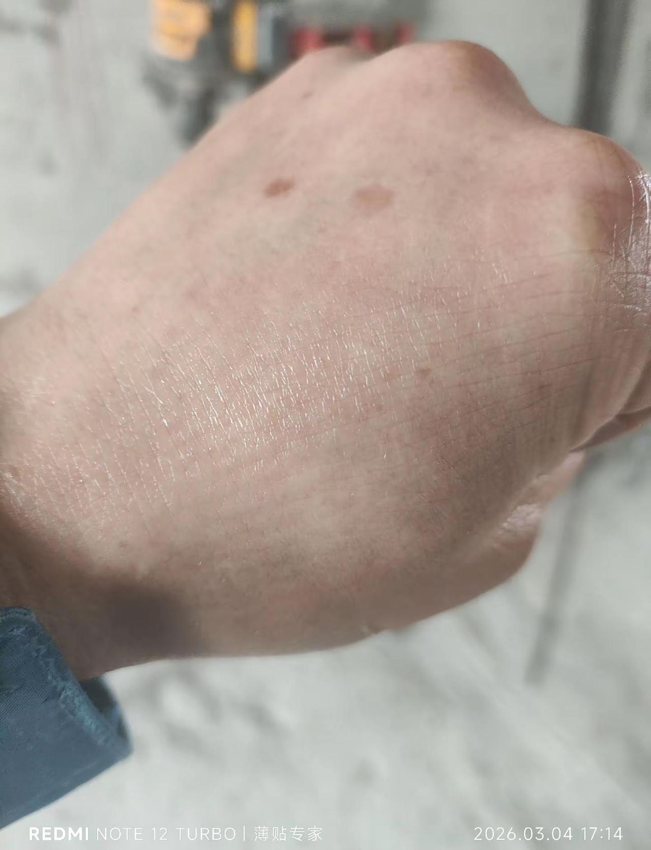 再好的皮也挡不住岁月的搓揉，今天正式上线了👌👌👌