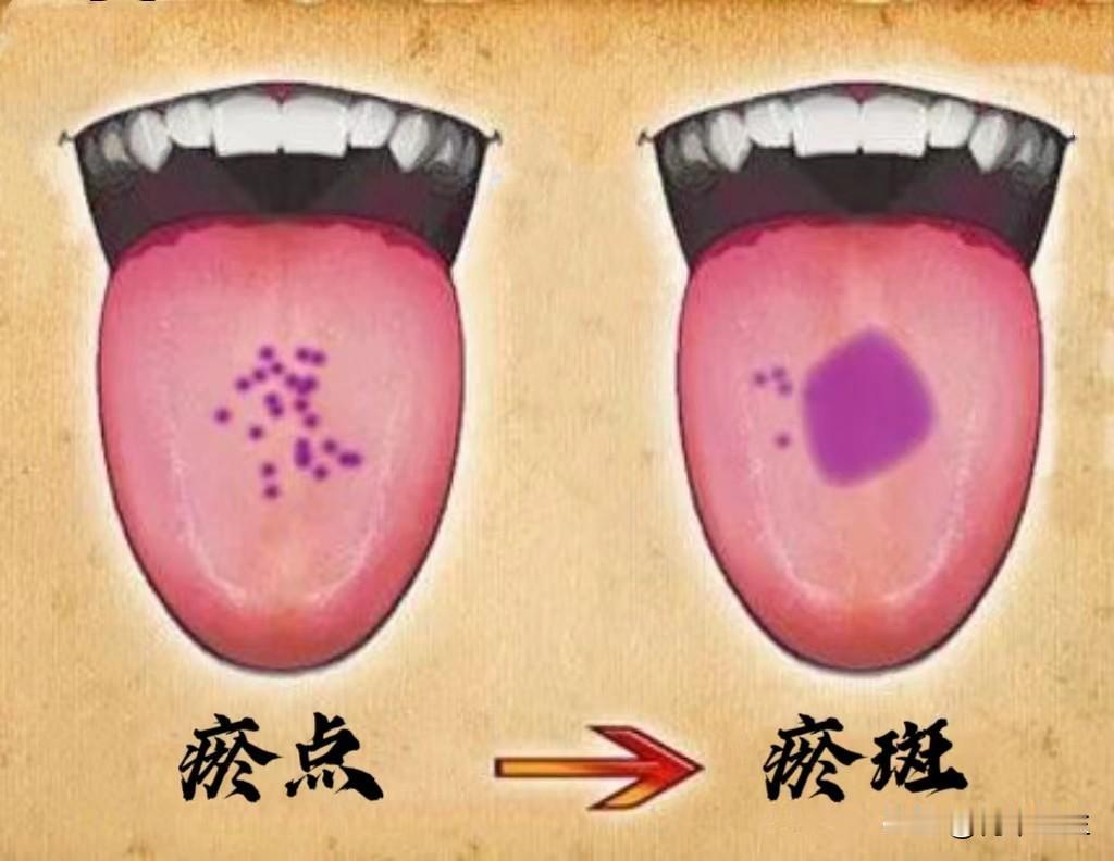 体内有瘀血的8大特征，你中了几条？
1、身体疼痛
原因：瘀血导致体内气血运行受阻