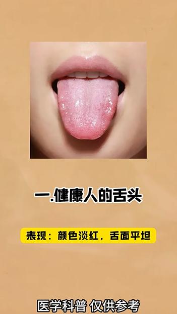 不同舌苔的症状表现