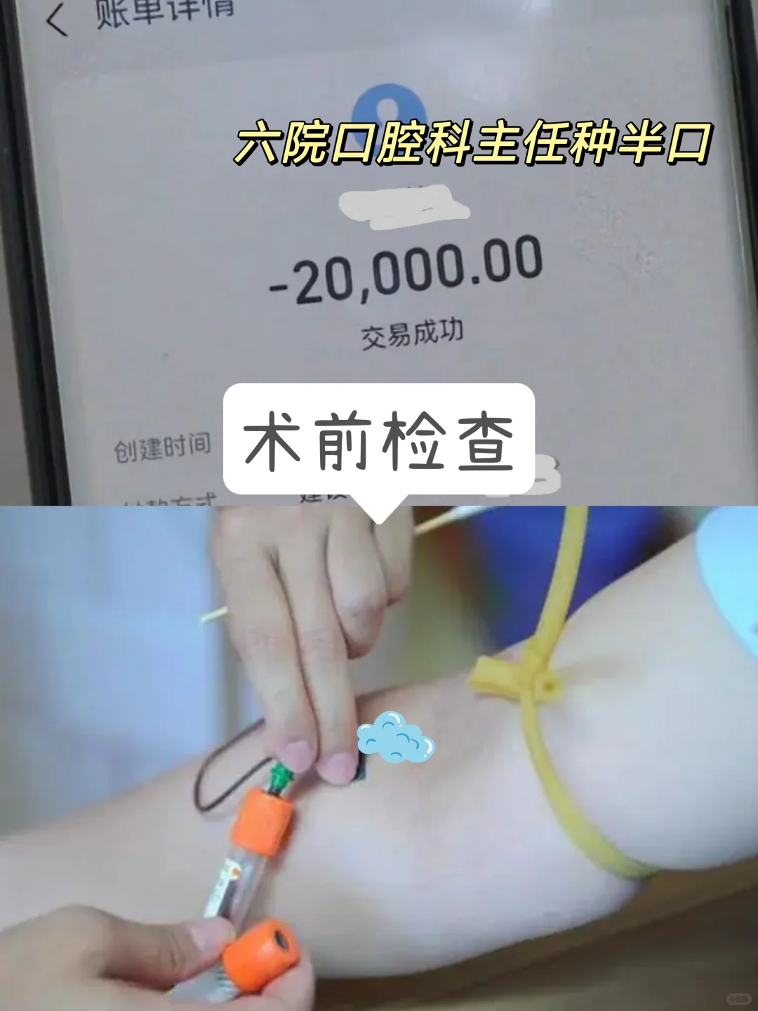 上海种植牙，找到六院口腔科主任种半口！