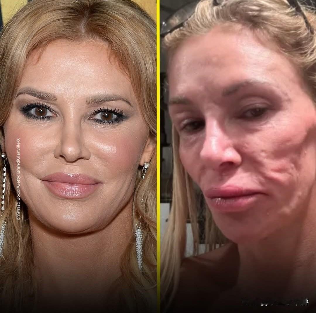 布兰迪·格兰维尔在面部毁容后经历了两年的痛苦，这场毁容如今终于有了一个令人震惊的