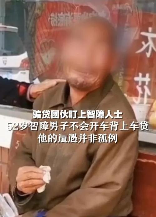 【智障群体遭骗贷黑手#】
#52岁智障大叔被骗背负高额车贷#9月4日，阳宪勇的手