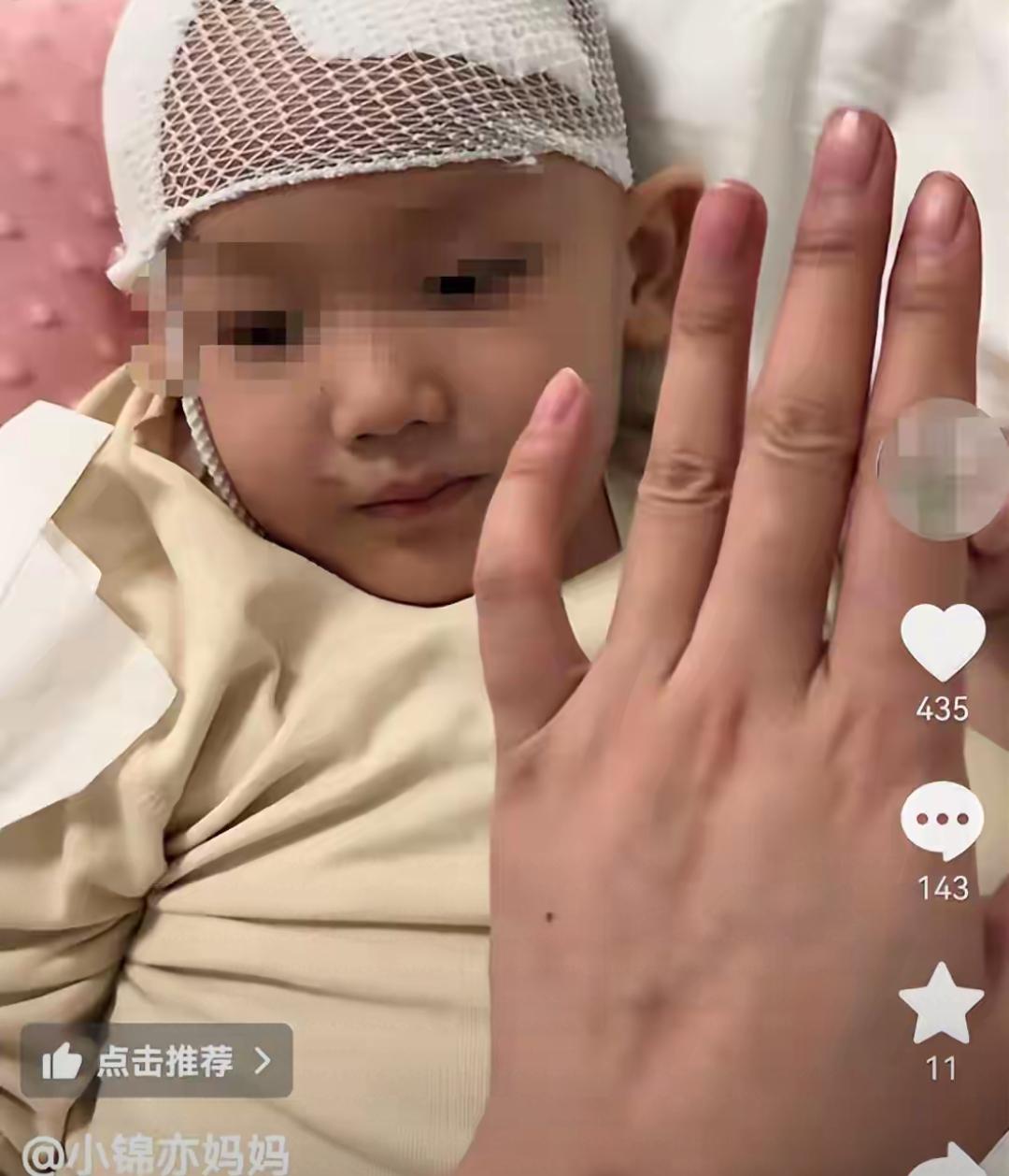 充气滑梯吹飞77米，2岁娃睁眼昏迷4个月！50万治疗费背后，是对孩子安全的漠视！