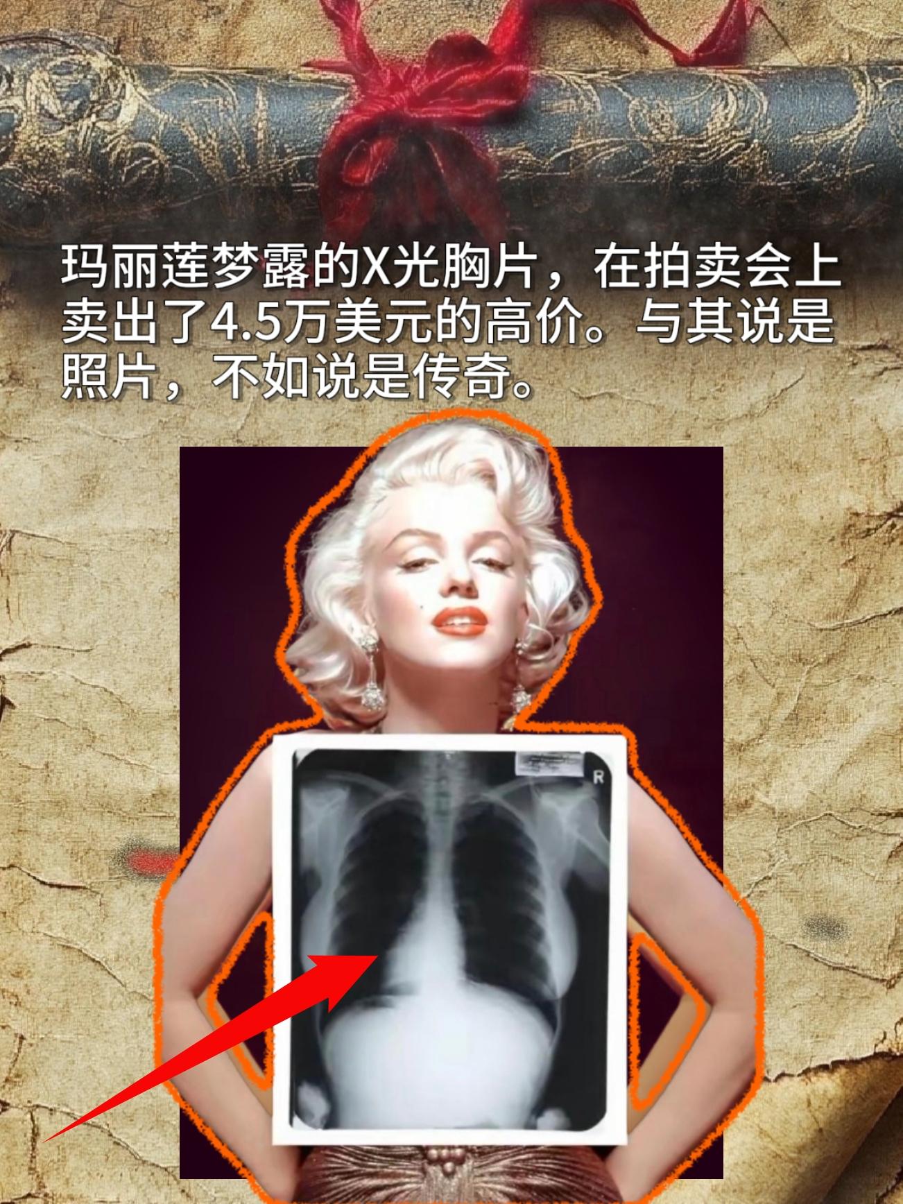 玛丽莲梦露的X光胸片，在拍卖会上卖出了4.5万美元的高价。与其说是照片...