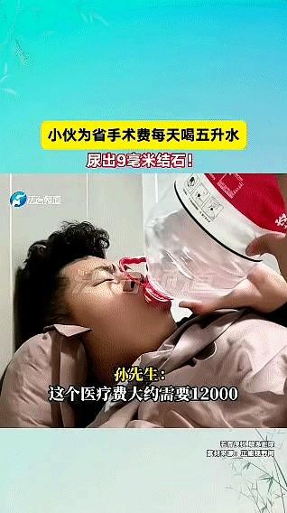 “这是个狠人！”近日，上海，男子上班时腰部剧痛，去医院一查，发现双肾都有结石，其