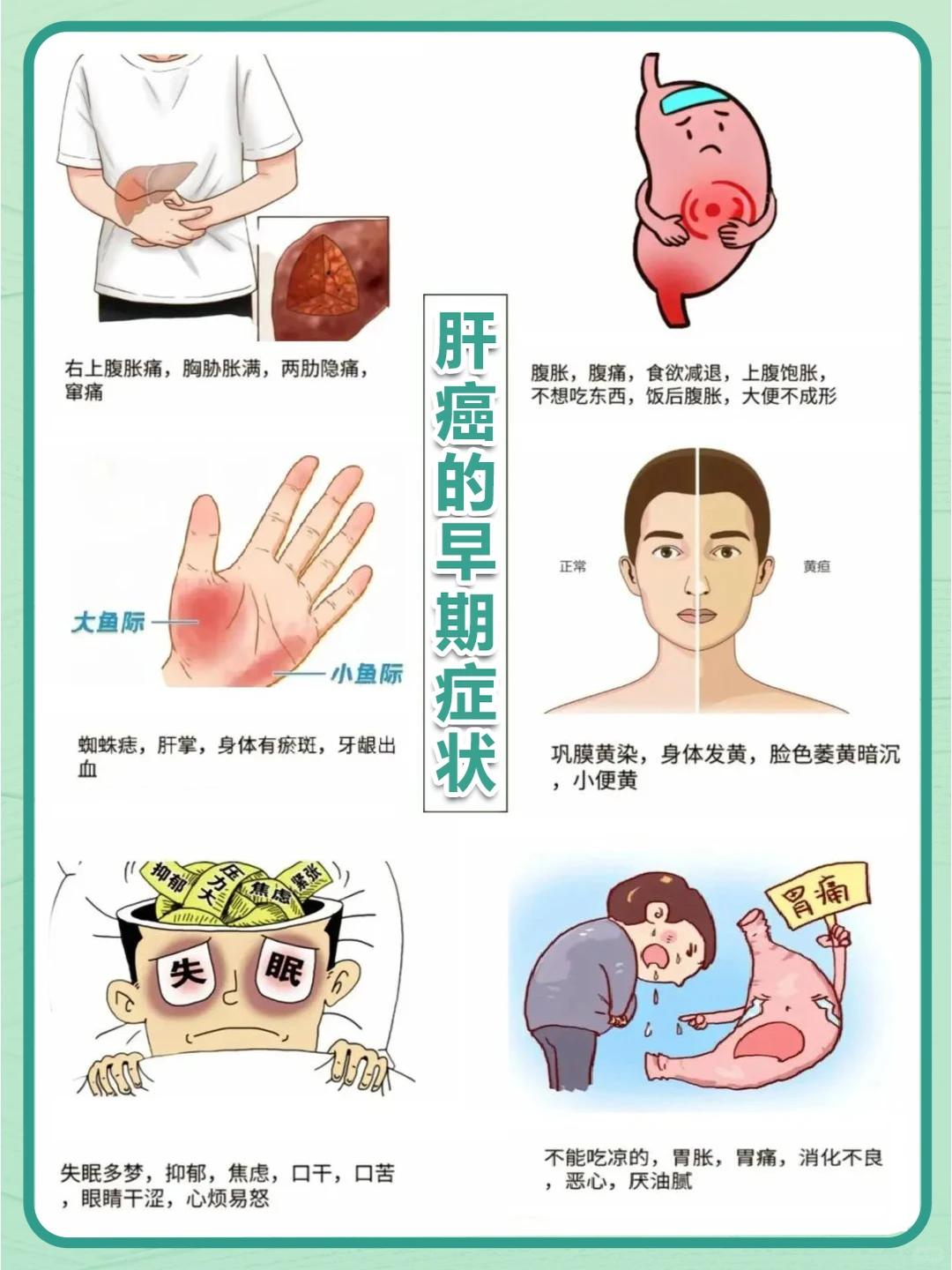警惕！肝癌的第一个信号，根本不是肝疼！这3个症状才是关键，赶紧自查！ 
你是不是