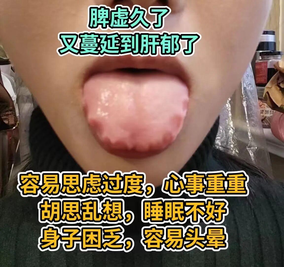 今日看诊中......对照自己看看你是哪一种