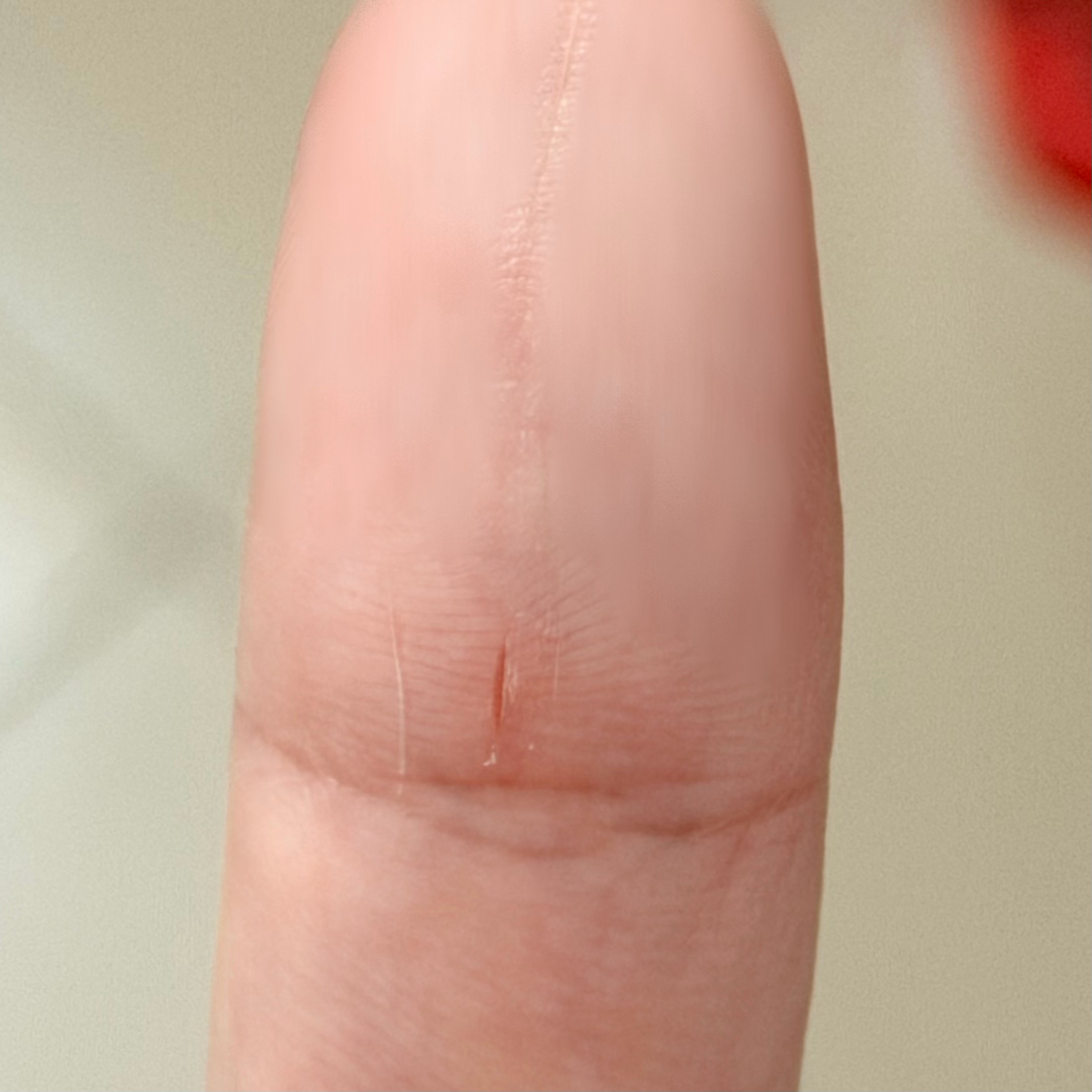 怎么能如此频繁的给自己手指喇一条口子（甚至次次后知后觉 [泪奔] ​​​