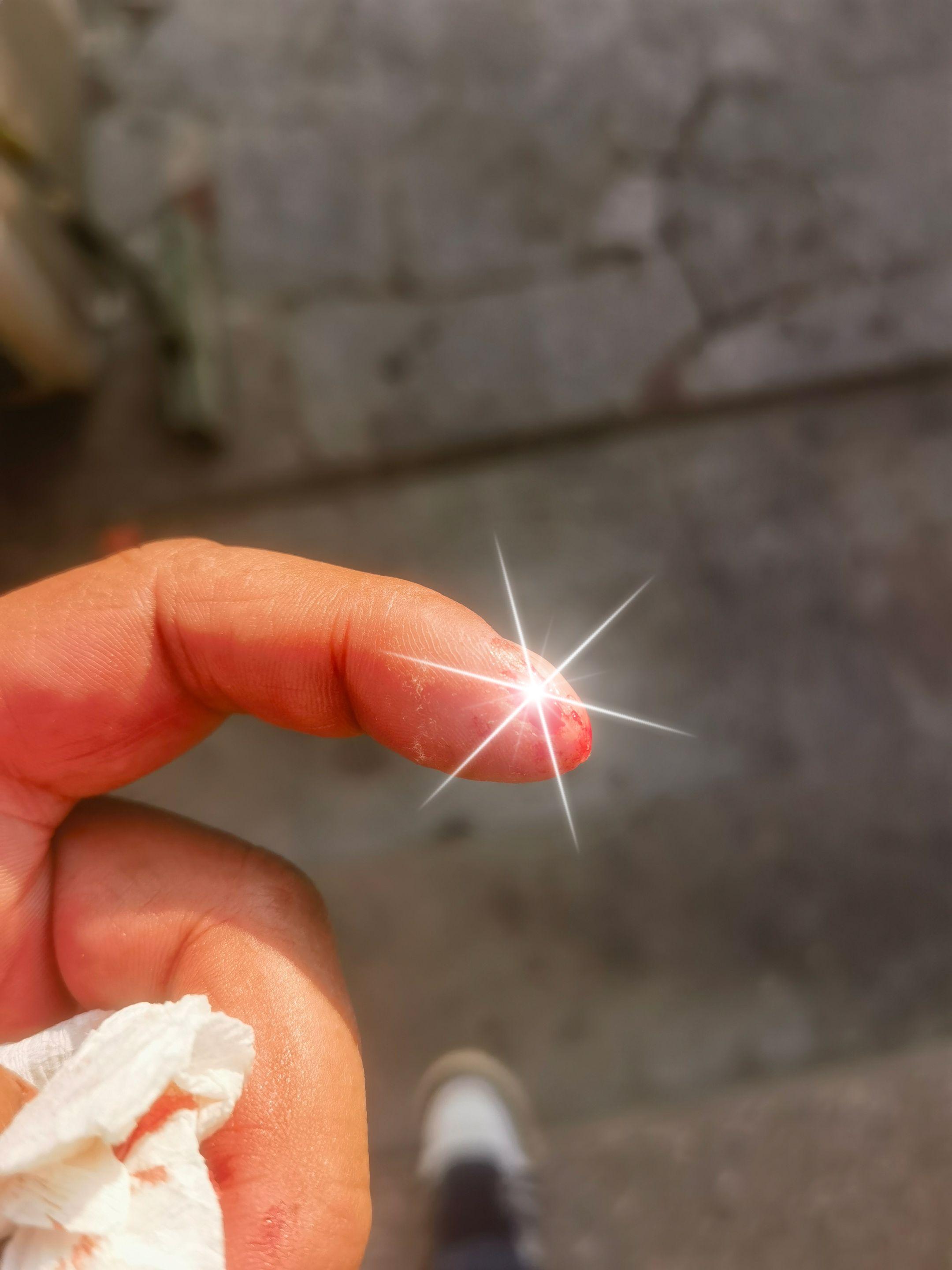 不疼真的不疼，还没有刀捅的疼！