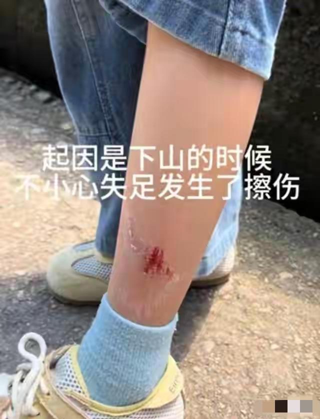 真的太寒心了！

江西景区这件事，直接撕开了当下人情最现实的一面。女子带娃爬山摔