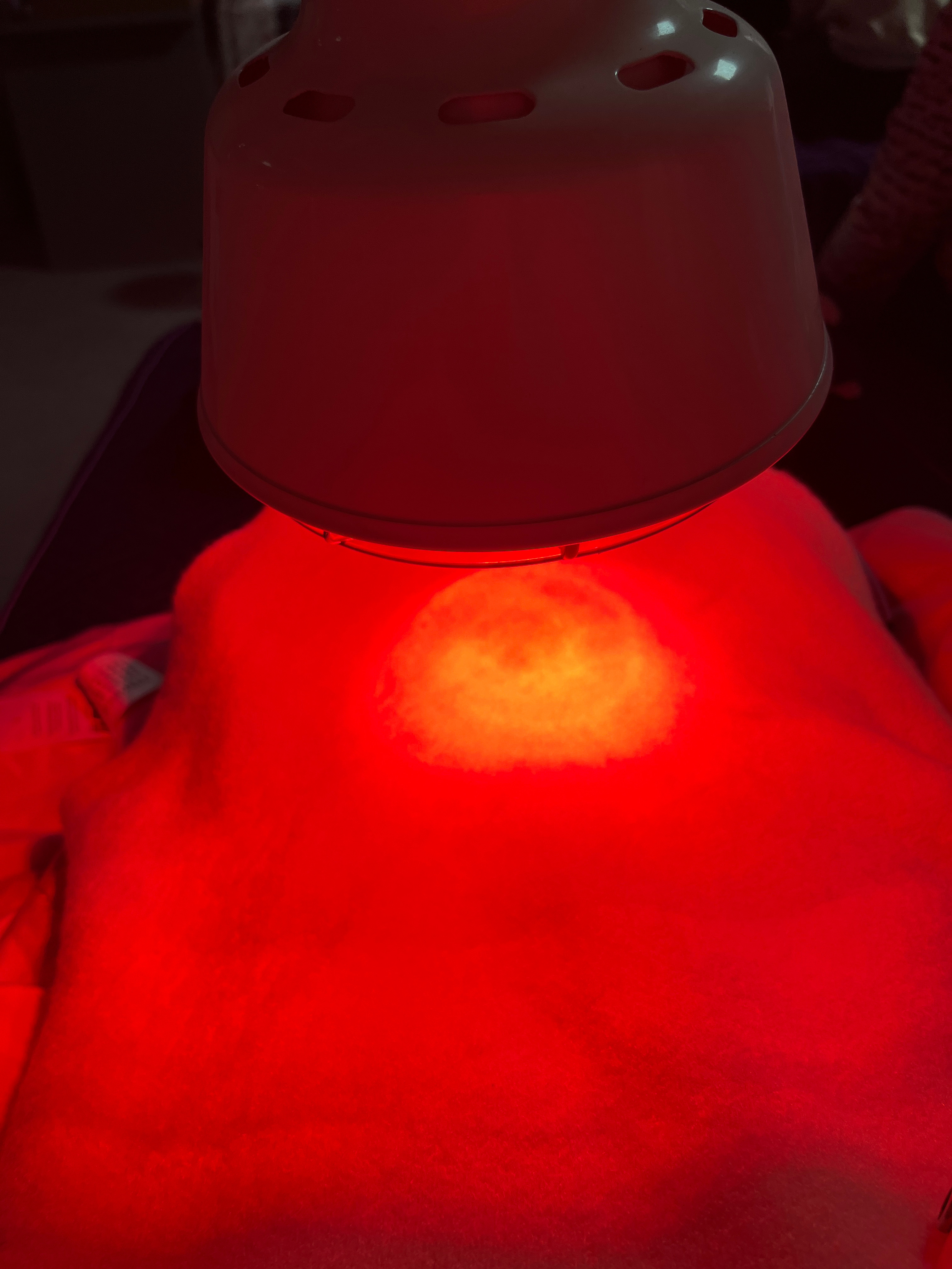 全民营养提升计划健康登顶计划产后恢复 在产后修复过程中，医生给安排了红外线灯，对