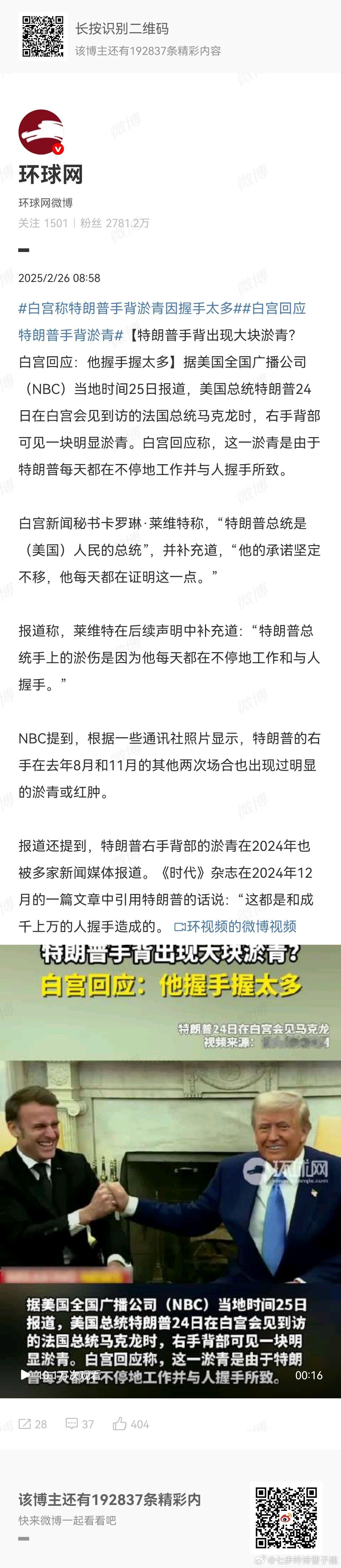 白宫称特朗普手背淤青因握手太多 输液输太多也会淤青[怒][怒] 