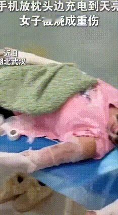 枕边充电睡大觉，女子70%烧伤悔断肠
 湖北一位女子睡前把手机放枕边充电，睡着后