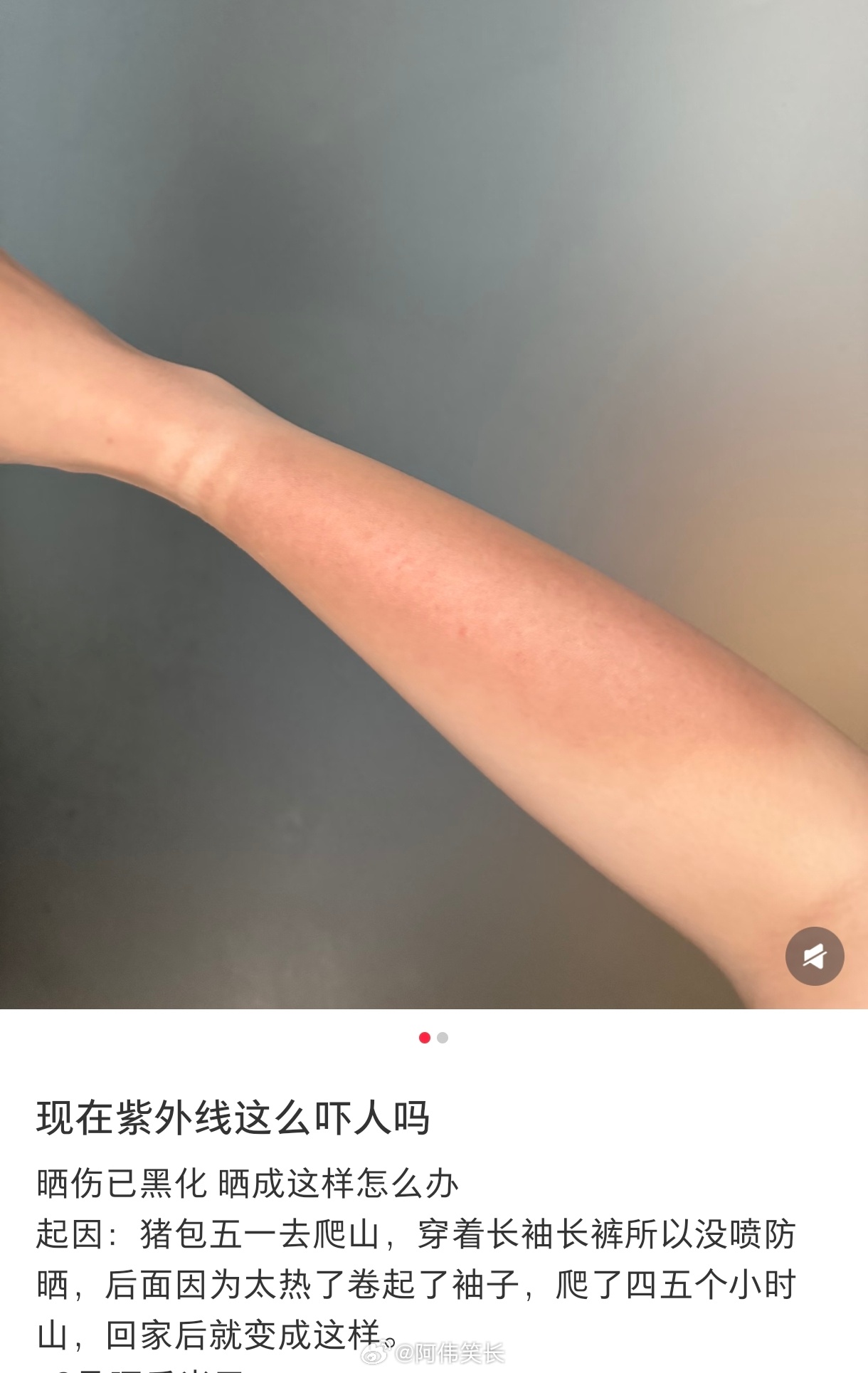 被夏天的紫外线背刺了夏天不轻易出门，出门全靠全副武装 