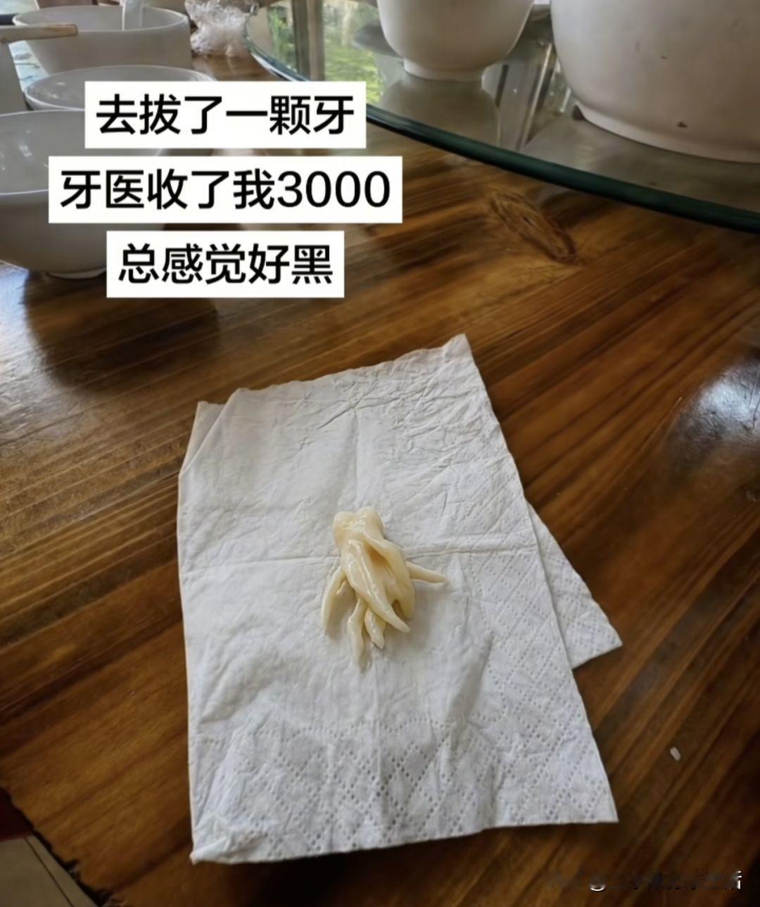 这样的牙齿还能完整给你拿出来 还能完成缝合，只要3000，你就偷着乐吧