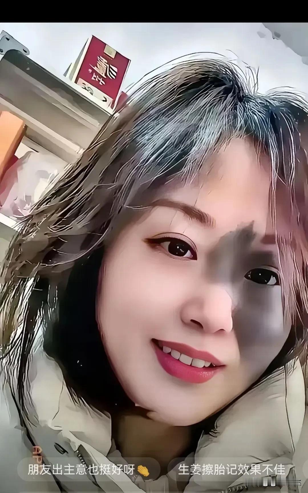 23岁江苏女孩，因脸上有胎记，去相亲屡屡受挫。这姑娘试了网上说的生姜泡水擦脸偏方