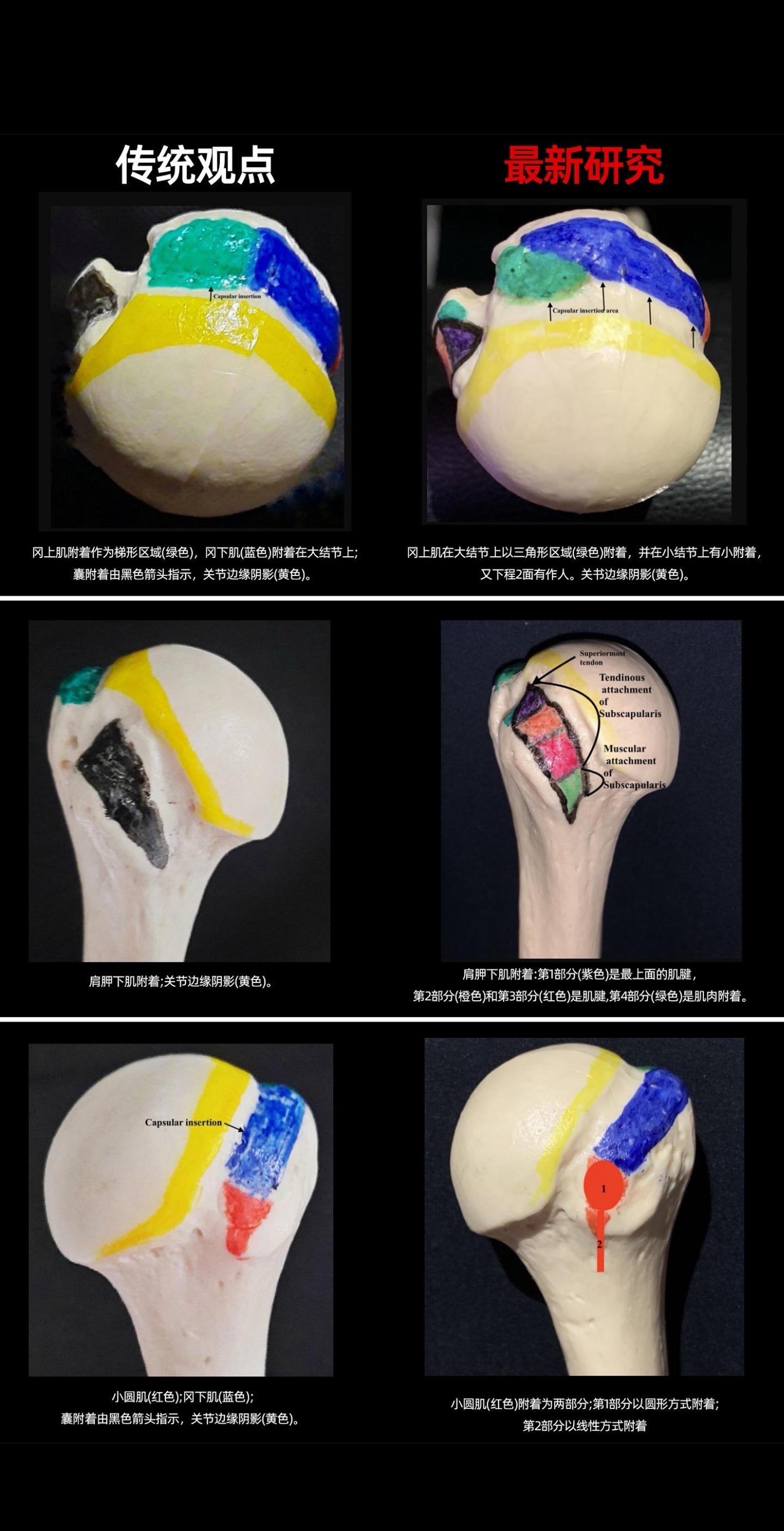 肩袖足印区再认识！肩膀疼？肩袖手术失败？可能是你的解剖知识该更新了！新...