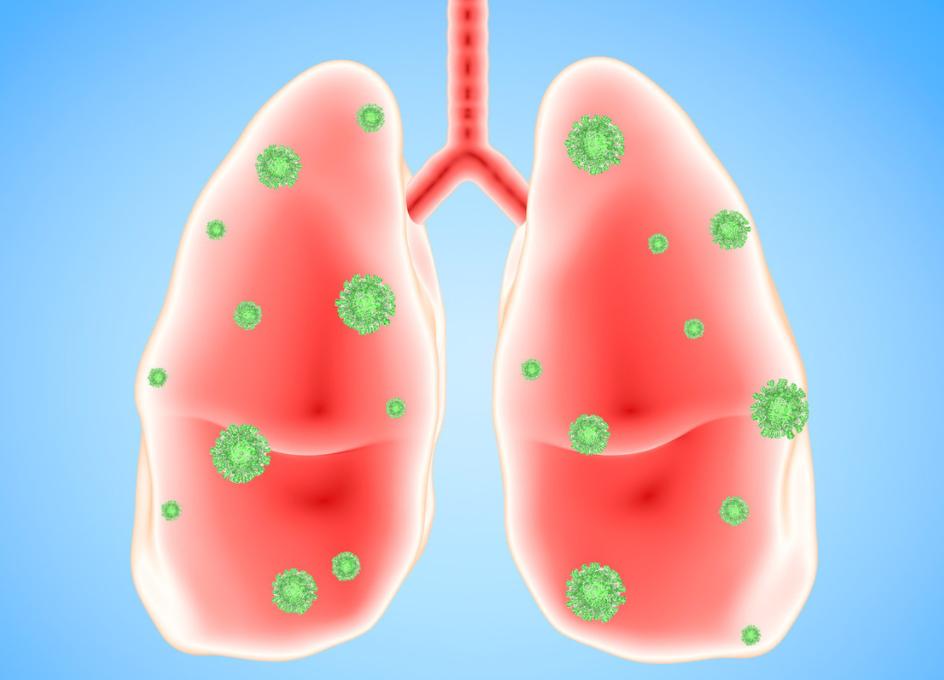 [what]老年人新冠康复出院需要注意什么？

自新型冠状病毒肆虐以来，在全球范