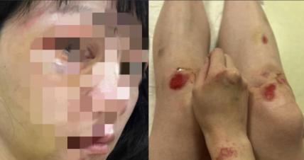 福建厦门，女子常年被丈夫家暴，被打的受不了就离家出走了，多年一直在外地漂泊流浪。