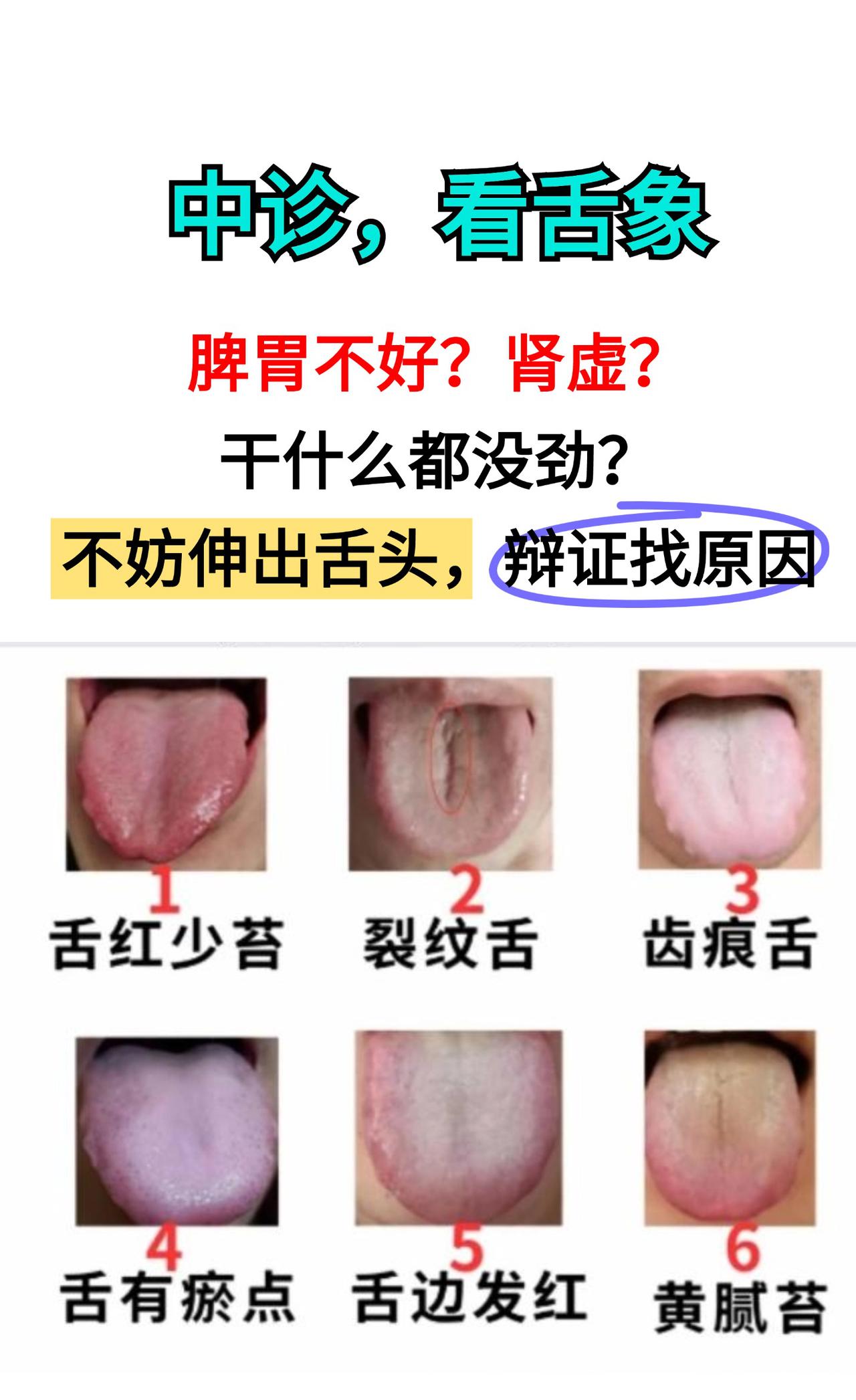 中医舌诊——脾胃不好？肾虚？吃药没有用？不妨伸出舌头，辩证找出原因！

#中医#