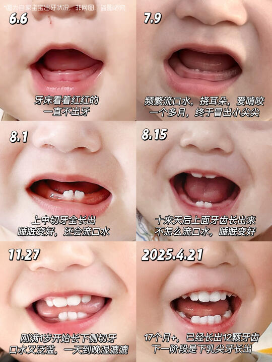 过来人听劝！！原来宝宝出牙这么难受……