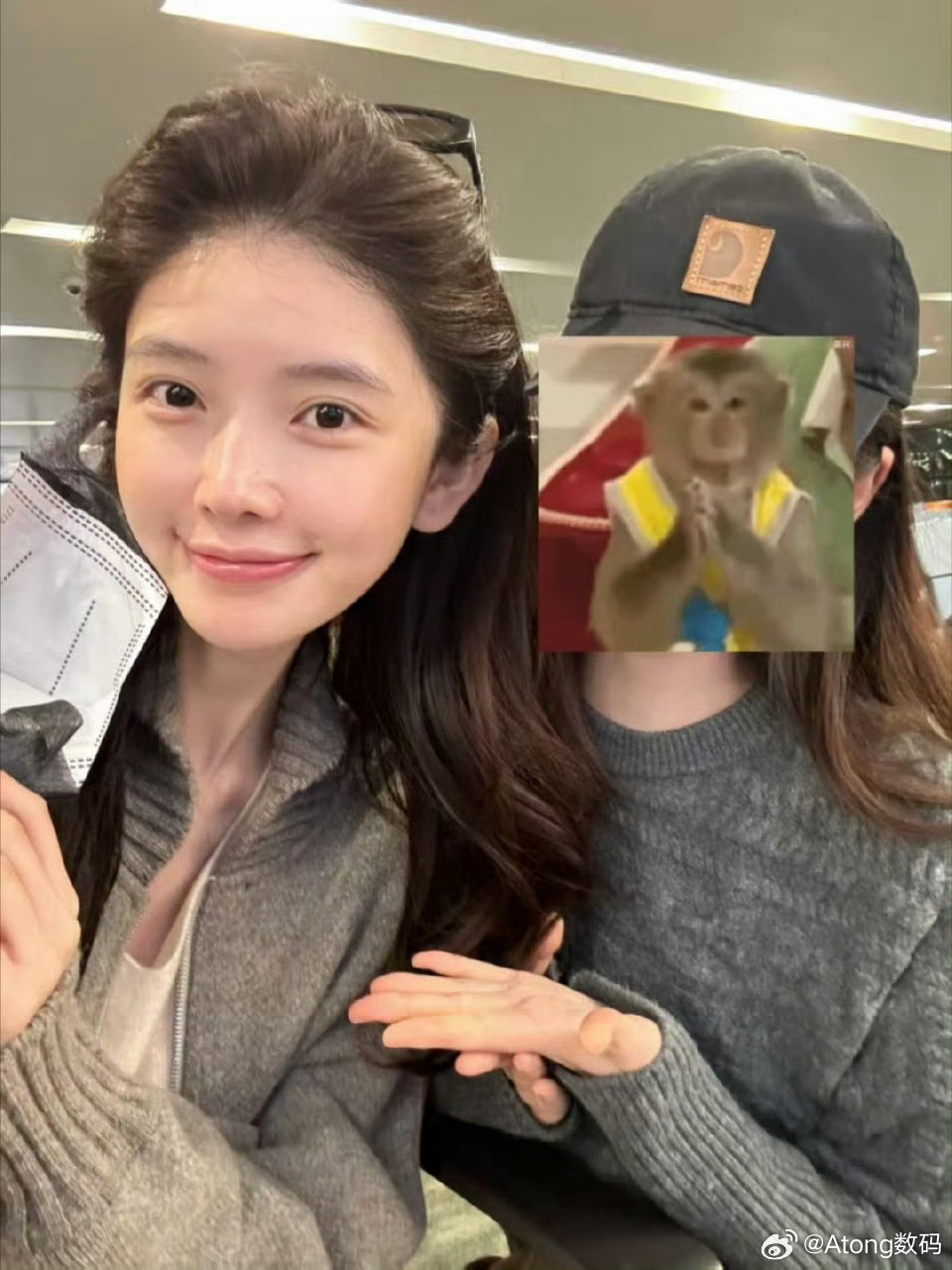 方圆鼻子上的疤痕就算做医美也还是很有自己的审美比千篇一律的好看多了 