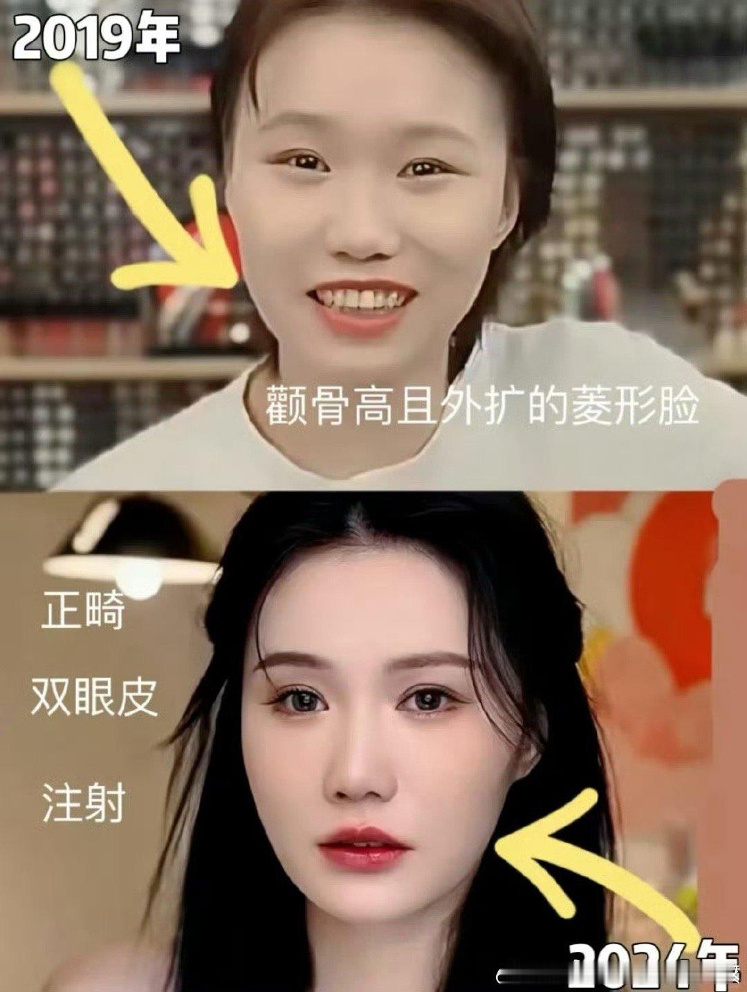 旺旺爆改 挣到钱了，才能改变生活与容貌 