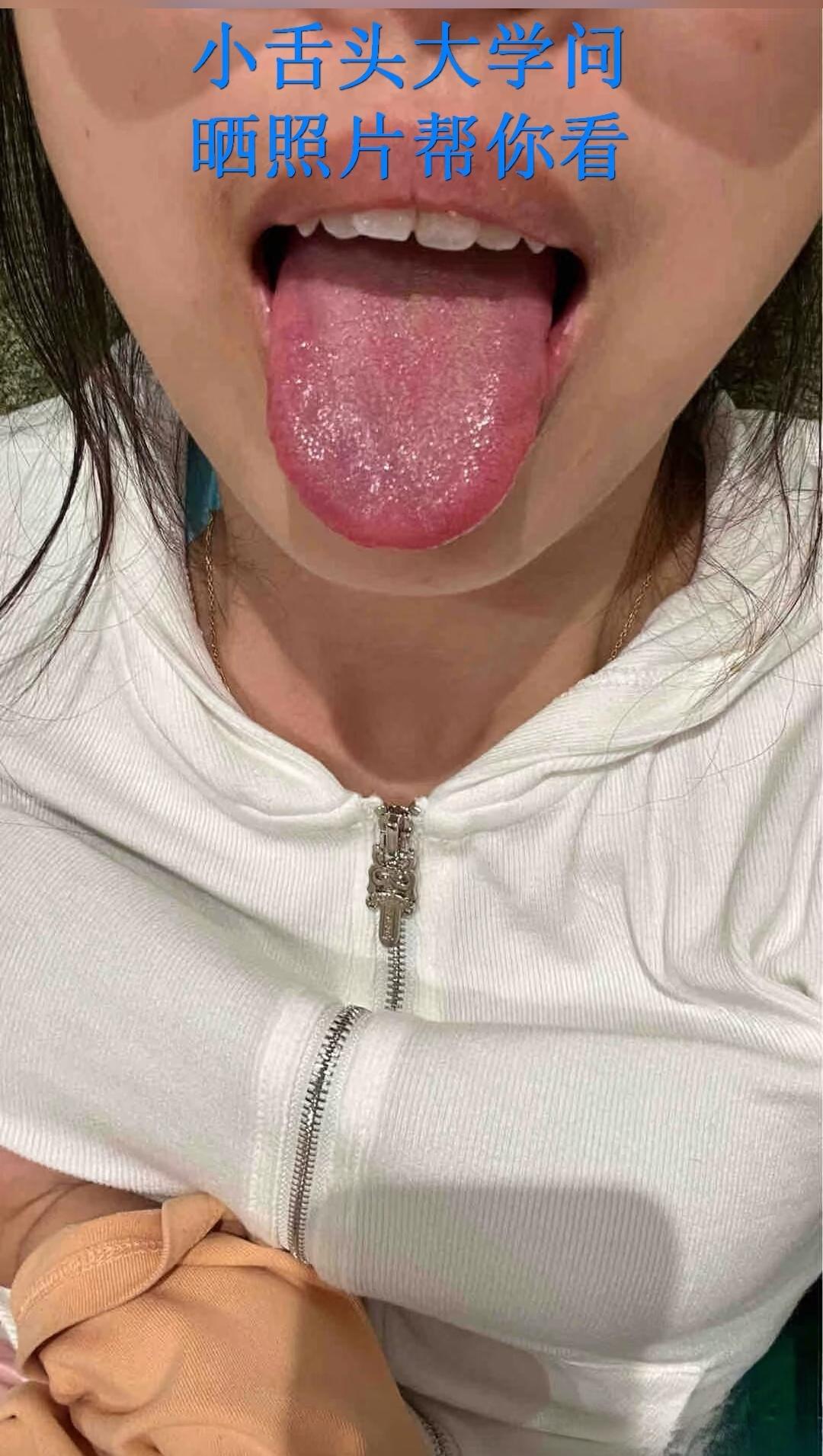 养生之道 古人的智慧 身体发出的信号一定不能忽视 舌头 裂纹舌