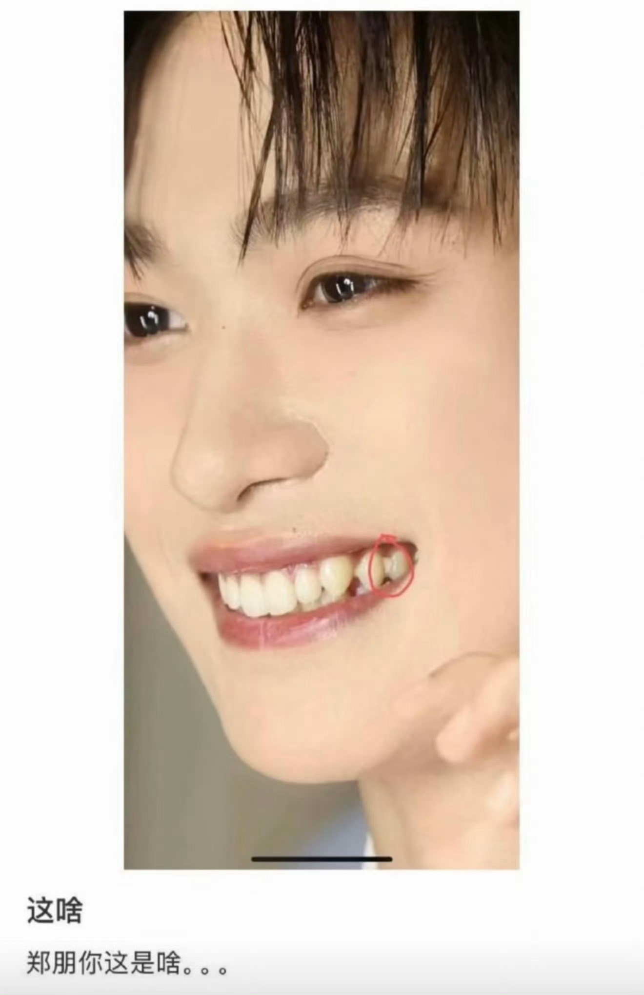 郑朋牙套这也能热搜 ​​​