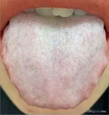 这是一位粉丝朋友的舌象

他说啊自己经常腰膝酸软，畏寒怕冷，神倦乏力，什么健脾的