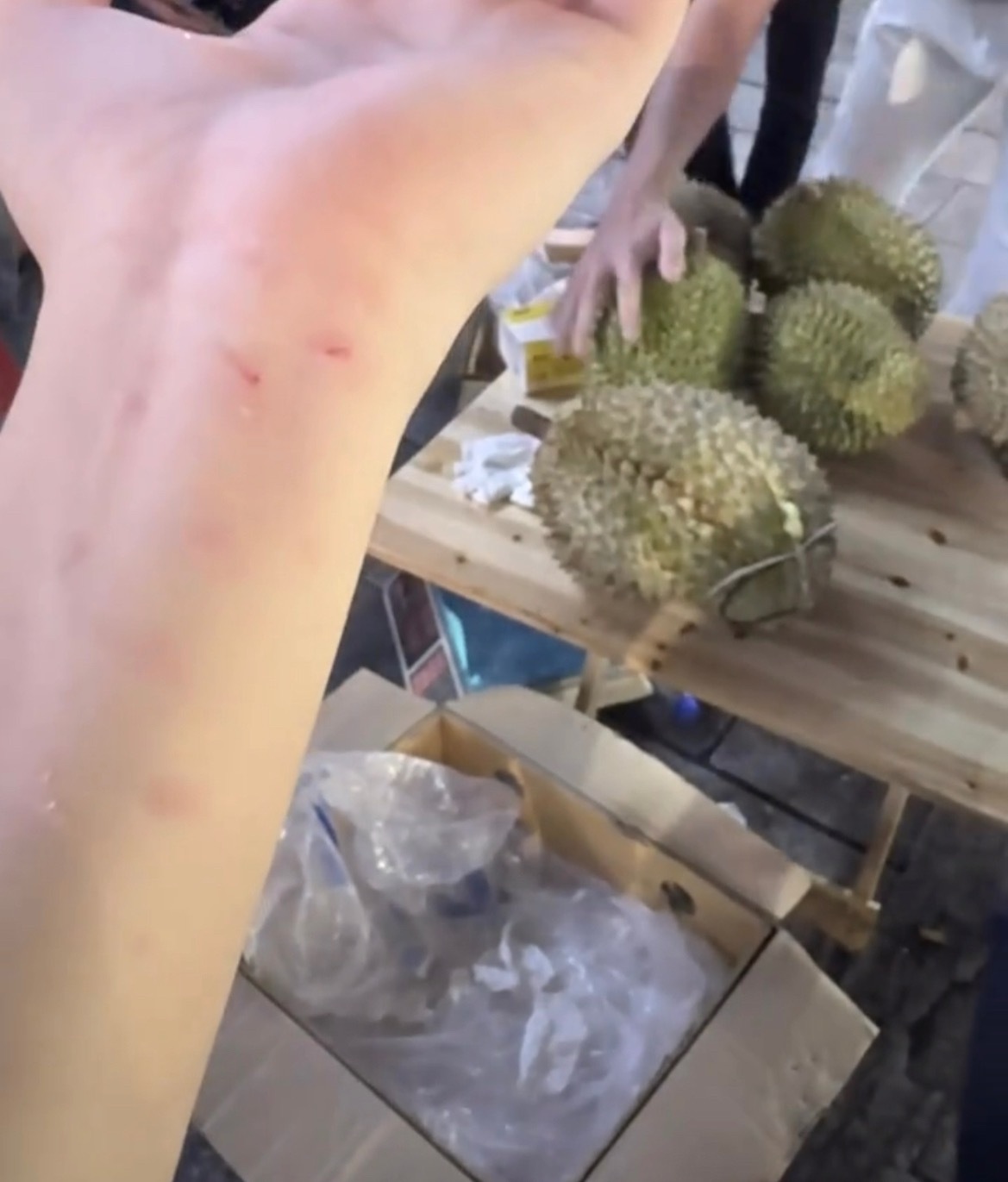 【玉林网友单手提榴莲不小心把手砸到了】7月2日，网友爆料称：玉林街头的单手提榴莲