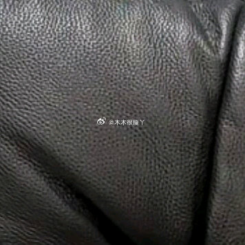 蛋蛋的双眼皮美美哒 