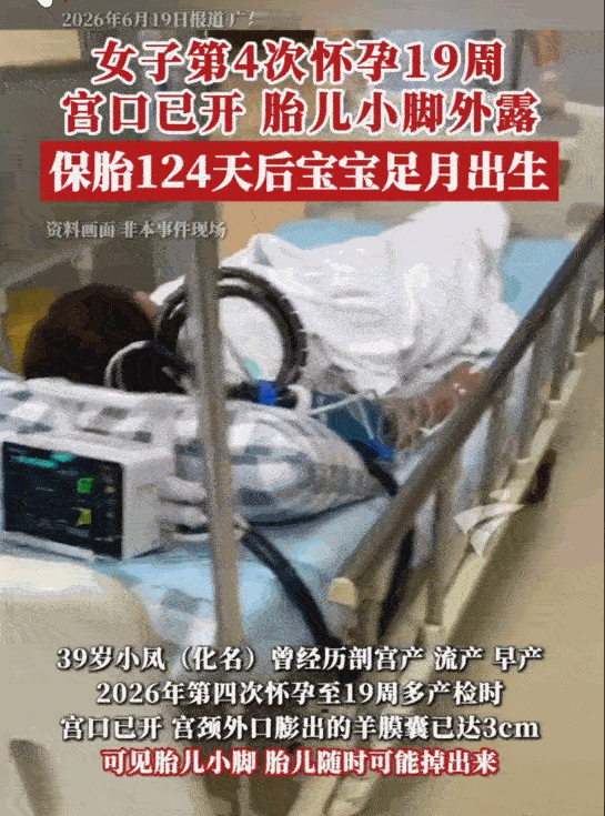 太伟大了！广东，一39岁的高龄女子，在孕19周时遭遇致命危机：宫颈机能不全导致宫