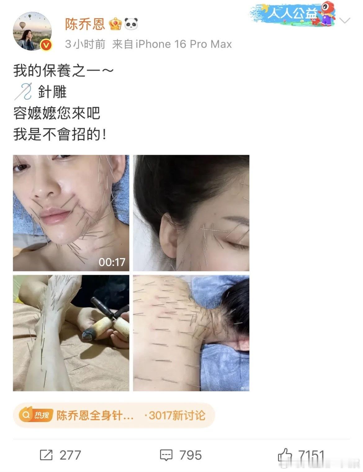 陈乔恩辟谣用针雕美容传闻哇但是这个成🦔刺猬一样确实看着很吓人啊！原来针雕是养生