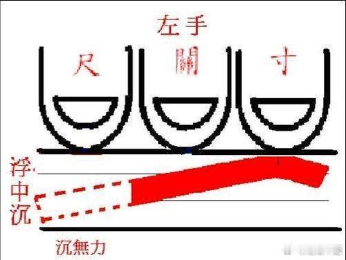 中医脉诊：沉脉主病；沉脉之状，取于肌肉之下得之。主脏病，沉滞伏匿。在寸为心肺郁伏