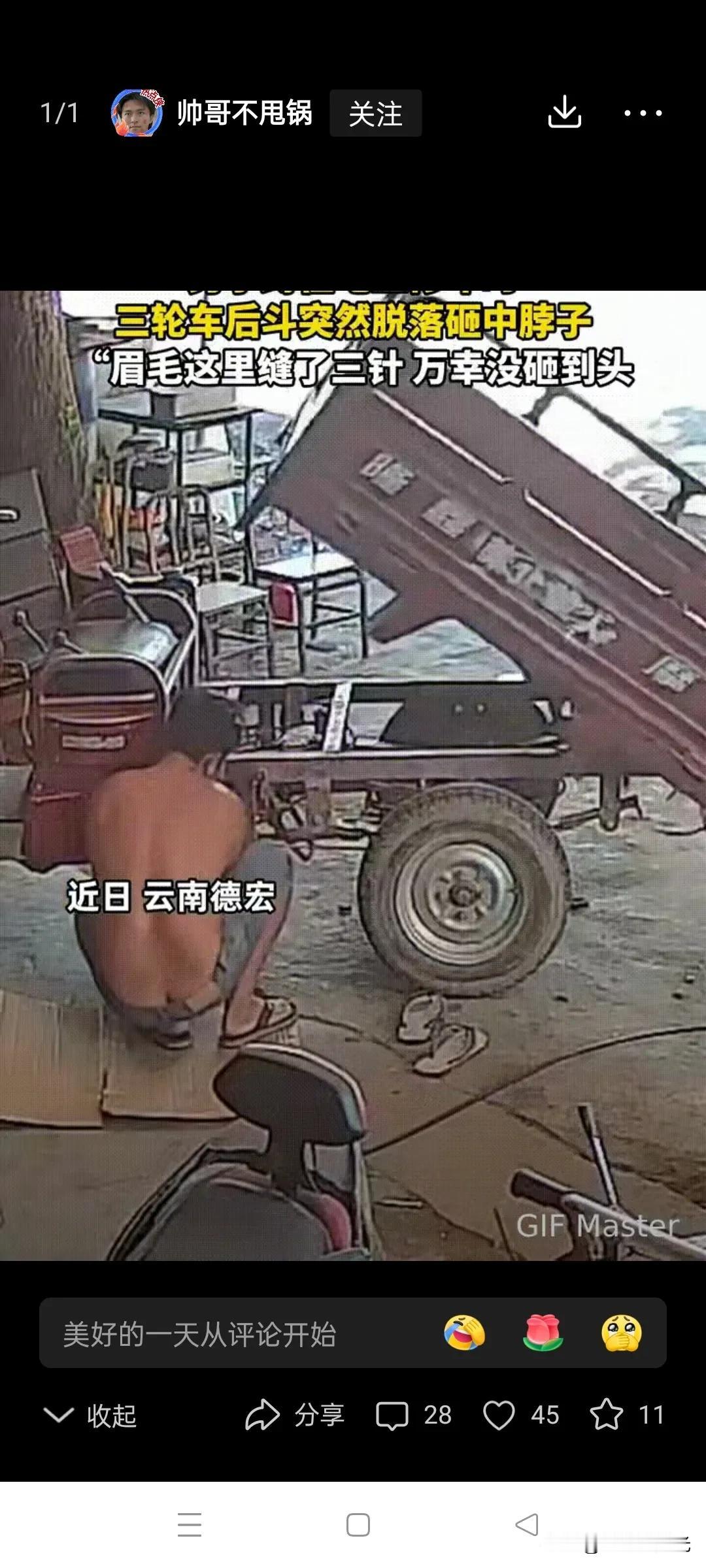 隔着屏幕都觉得好疼

云南德宏一男子修车时，由于没有固定支撑，三轮车后斗突然脱落
