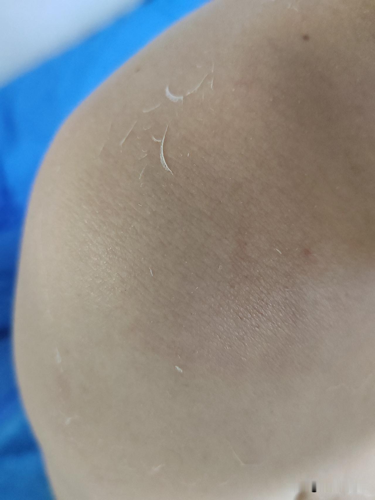 前几天身体不舒服的时候，别人说我可能是身体缺钙，说我天天呆在厨房里，不见阳光，不