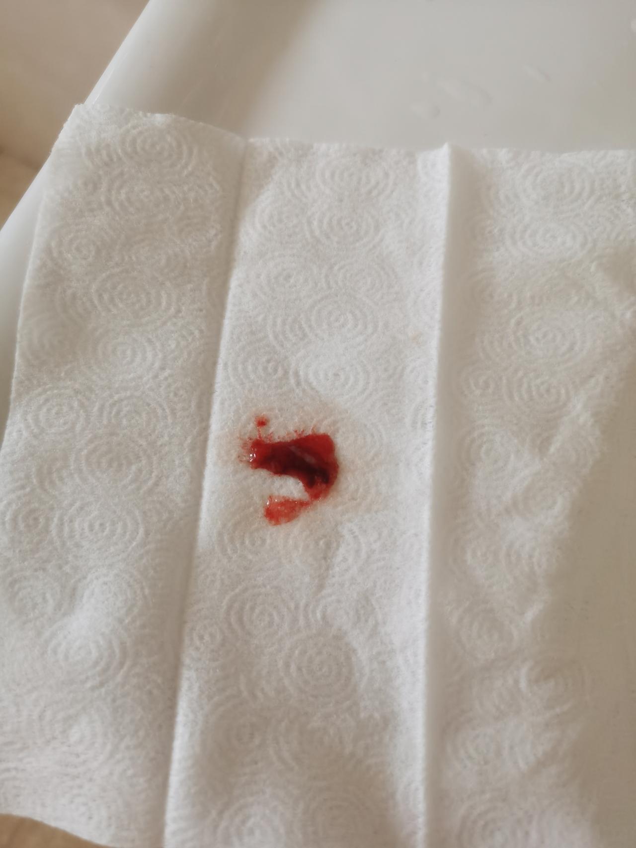 【清了一下嗓子就口吐鲜血吓死人了】
今天突然感觉嗓子不舒服，就咳嗽了一下，尽然吐