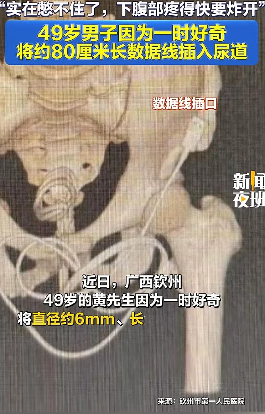 见过狠的没见过这么狠的！哥你是个狠人啊[赞]