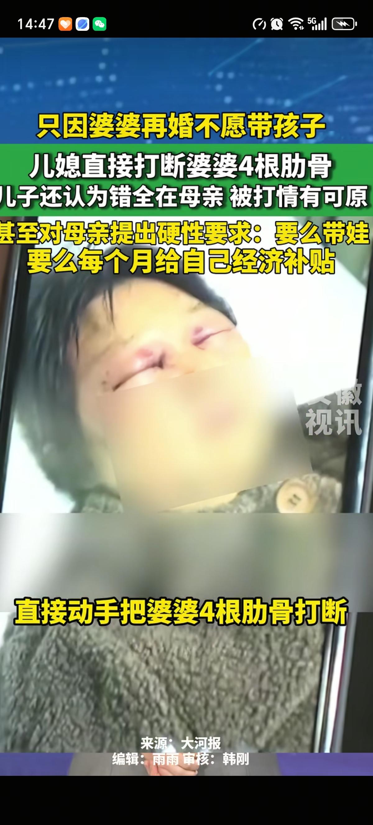 儿媳妇因为婆婆既不帮着自己带孩子，也不每个月给自己钱补贴生活，断了婆婆4根肋骨。
