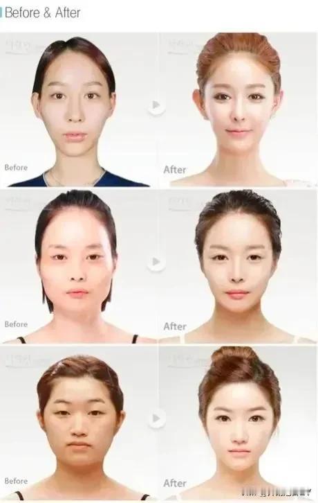 整了是好看不少啊，怪不得大家说韩国整容术是亚洲四大邪术”之一！
四大邪术是指泰国
