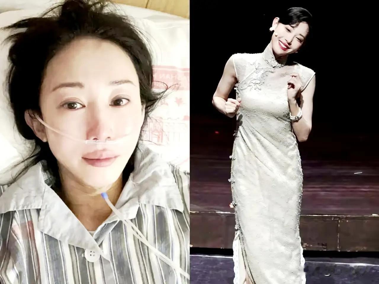 最戳人的成年人体面！朱洁静抗癌经历曝光：分手的前任，救了她一命！

 
特意去翻