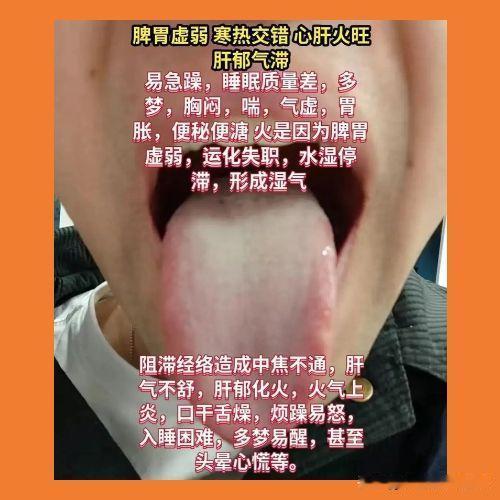 今天没啥事，来给大家看看舌象吧！

有需要的现在就可以把舌象发过来了，我争取30